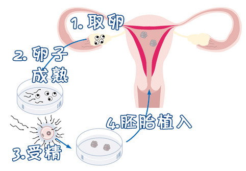 关于供卵代怀包生男孩机构